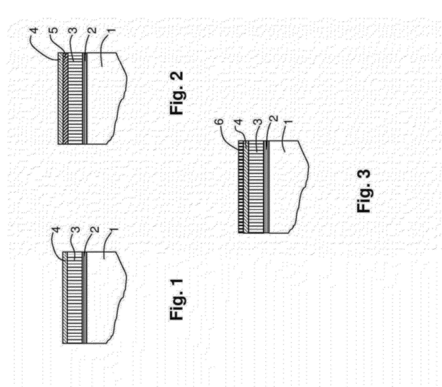 Multilayer thermal barrier coating