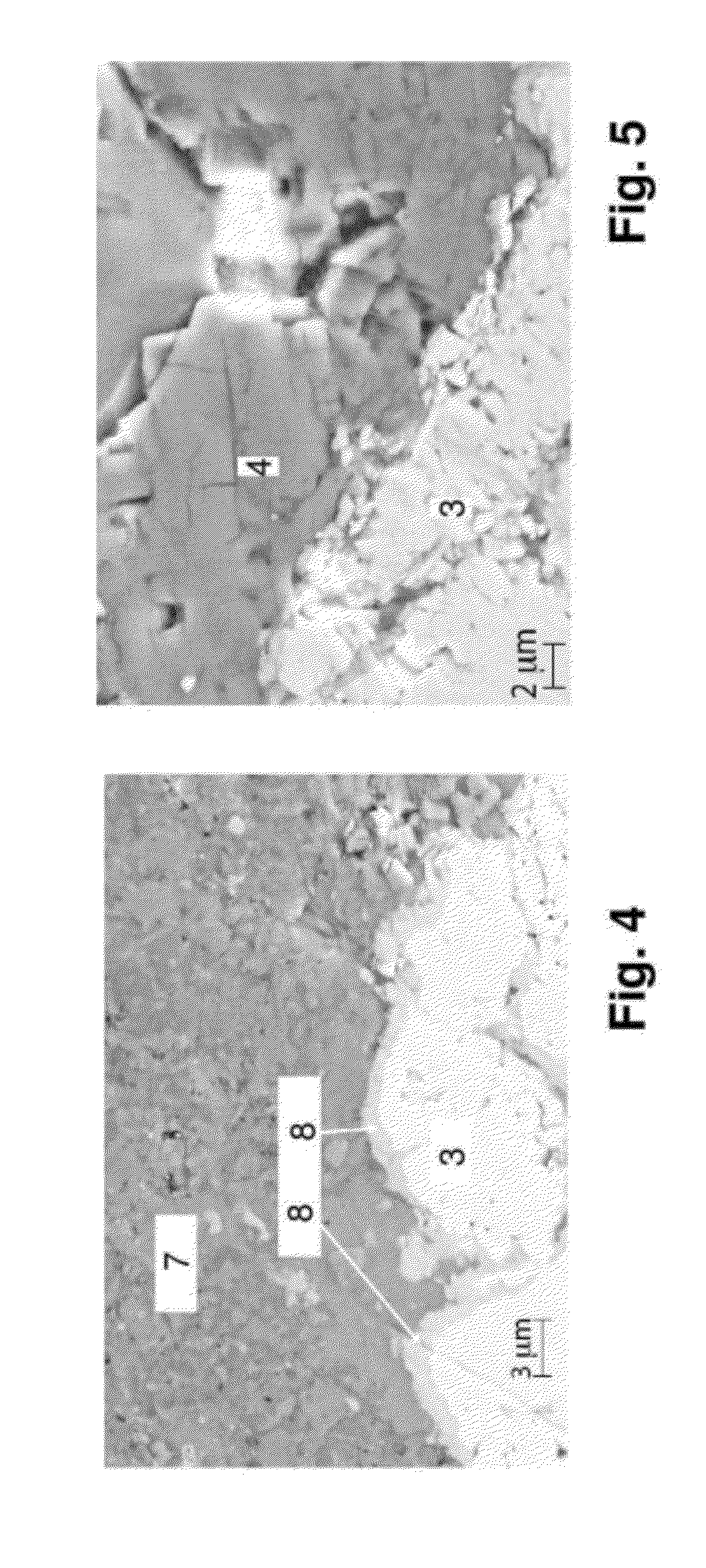 Multilayer thermal barrier coating