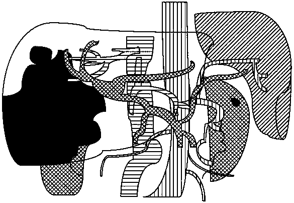 Three-dimensional virtual organ volume calculation method, device, storage medium and equipment