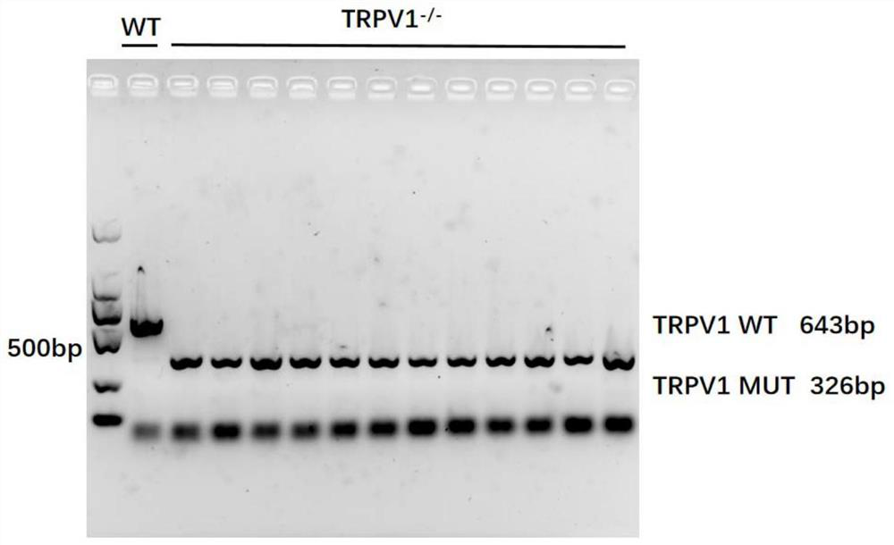 Application of TRPV1 in screening or preparing medicine for preventing, relieving and/or treating liver diseases