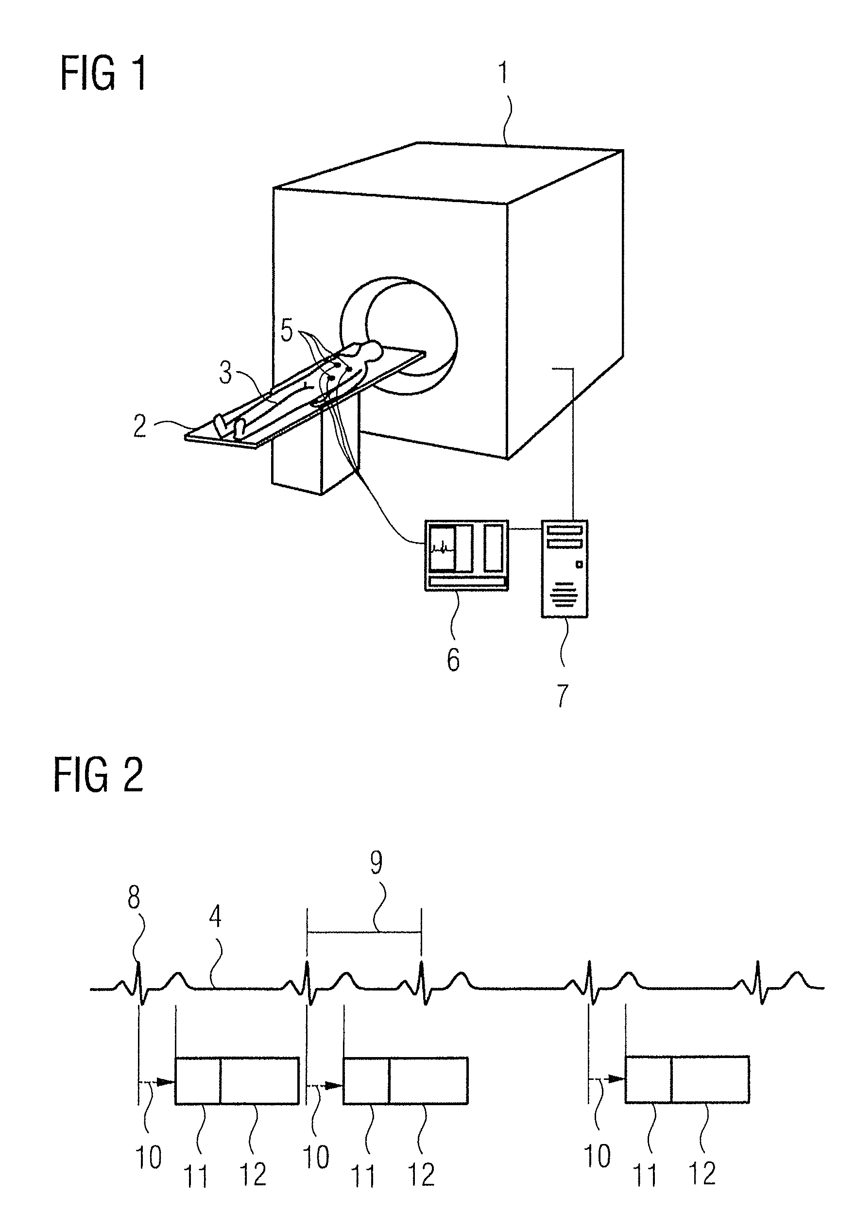 Method and magnetic resonance tomography apparatus for triggered acquisition of magnetic resonance data