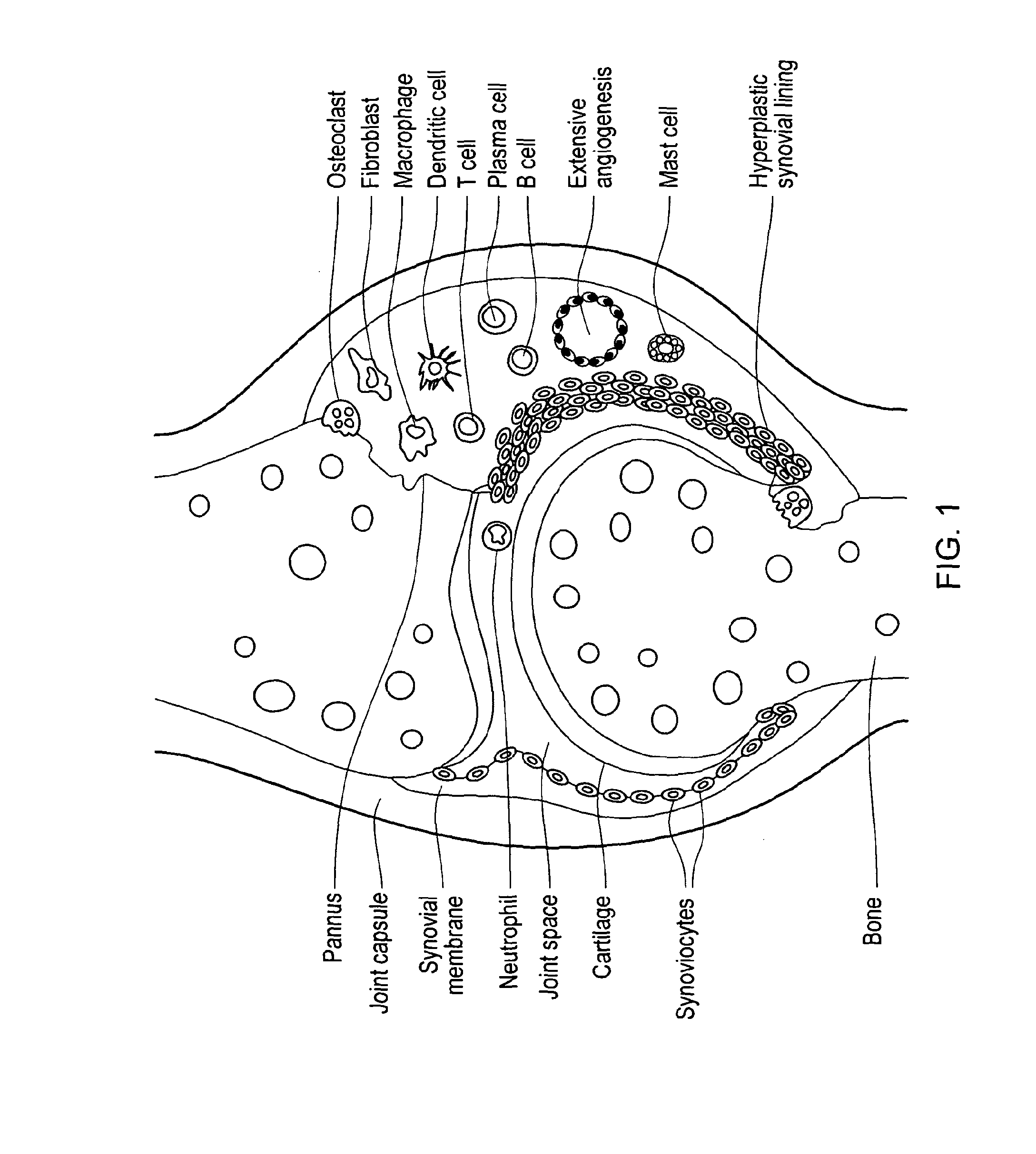 Antibody specifically binding synovial microvasculature of arthritis patients