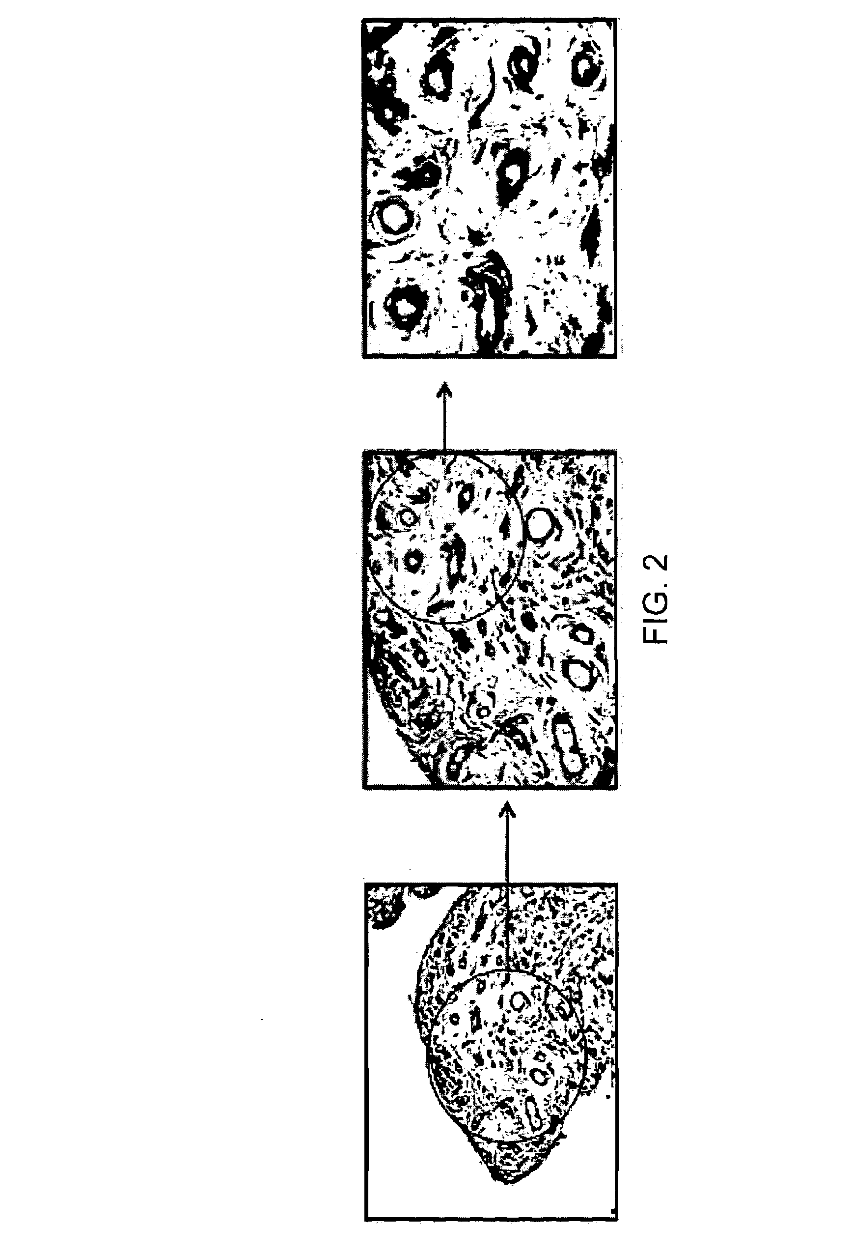 Antibody specifically binding synovial microvasculature of arthritis patients