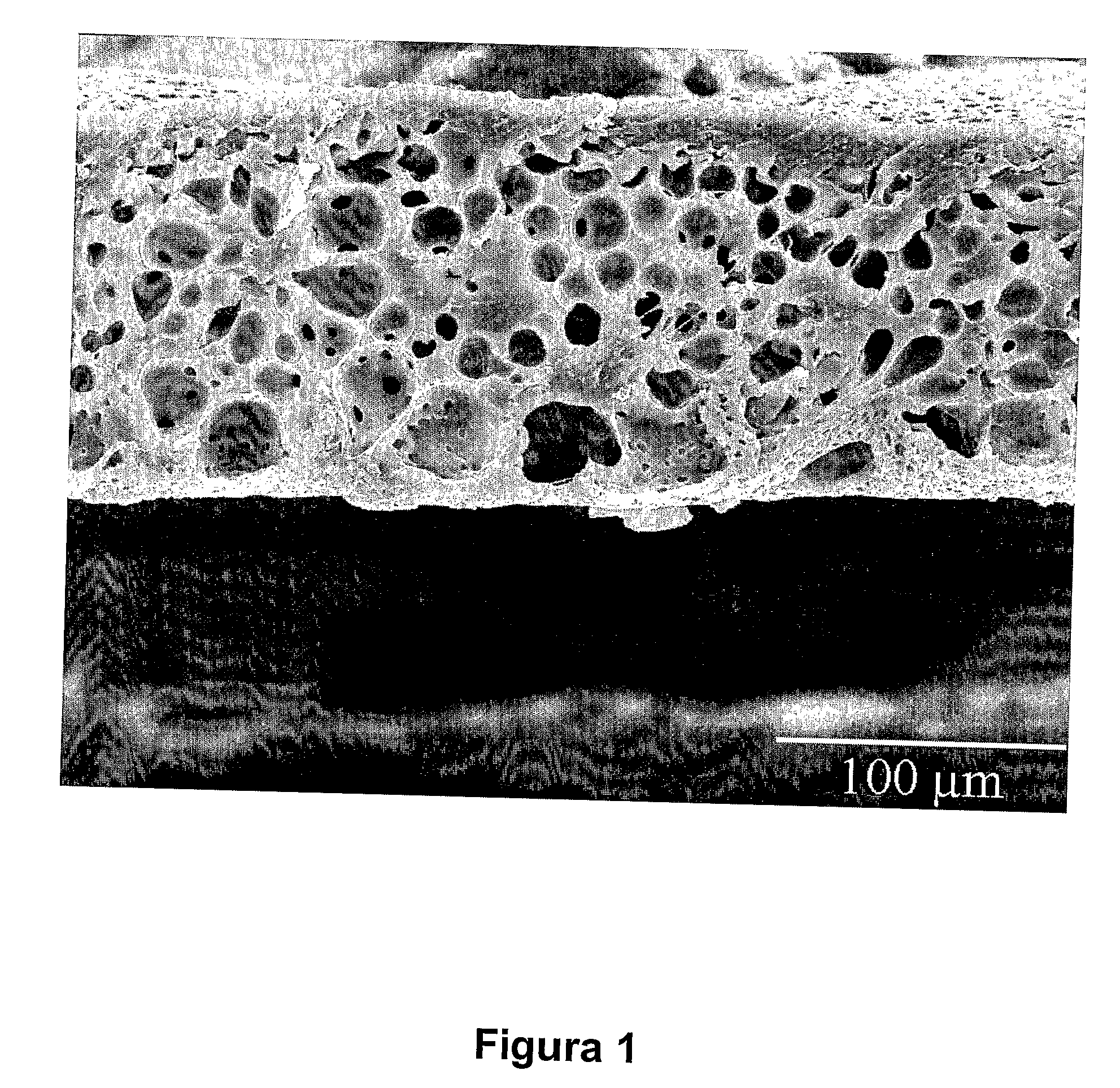 Process of synthesis asymmetric polyurethane based membranes with hemocompatibility characteristics and membranes obtained by said process