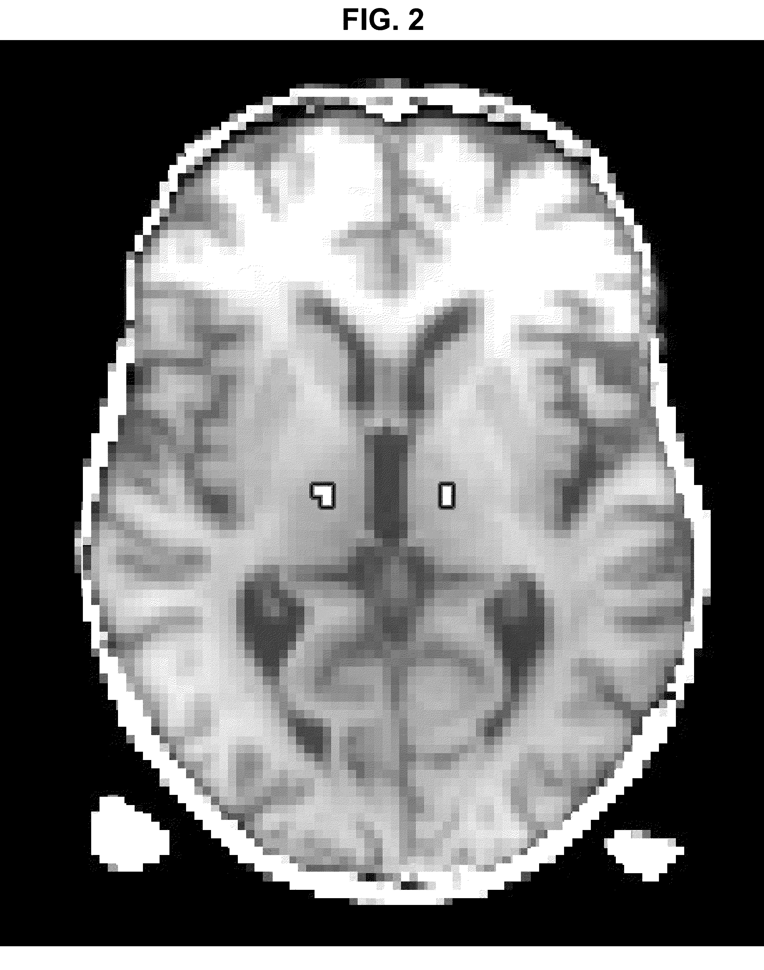 Method for deep brain stimulation targeting based on brain connectivity