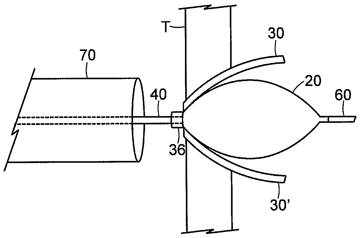 Inflatable access device