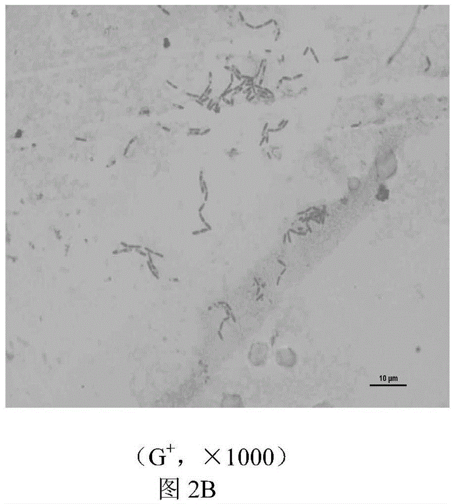 Selective breeding and application of bacillus subtilis for alleviating stress of livestock and poultry