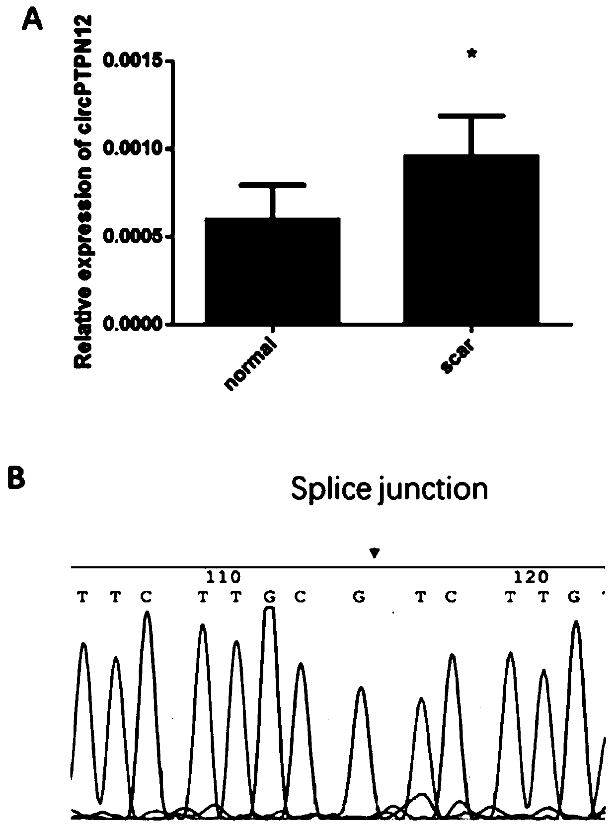 Application of hsa_circ_0003764 as marker to preparation of diagnosis preparation for intrauterine adhesion