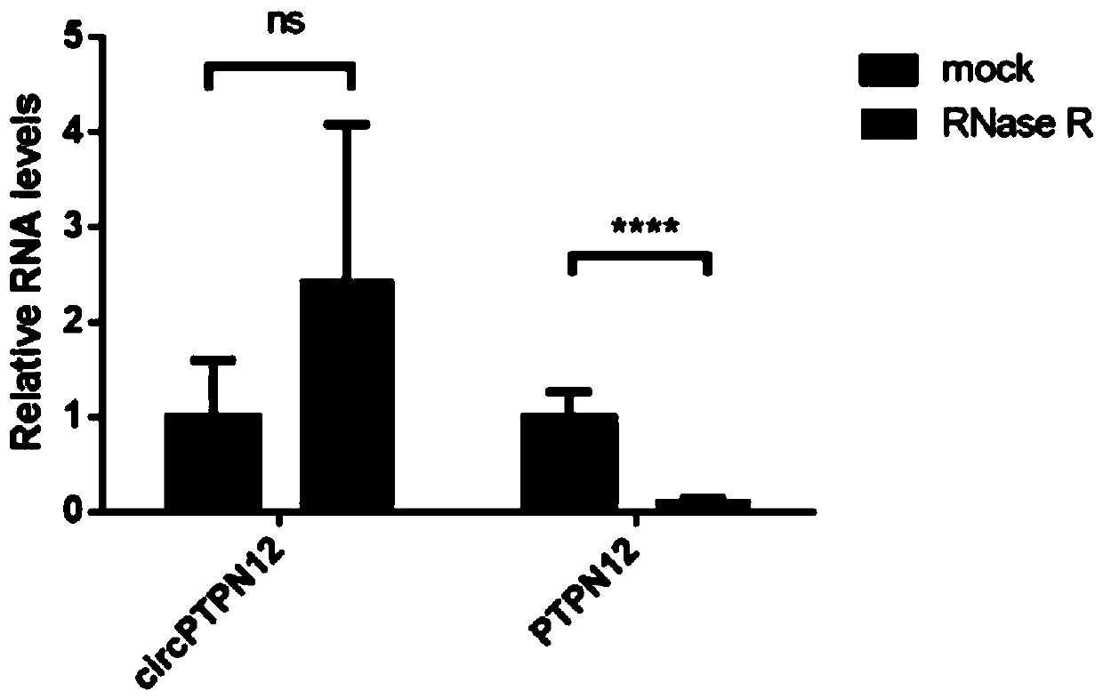 Application of hsa_circ_0003764 as marker to preparation of diagnosis preparation for intrauterine adhesion