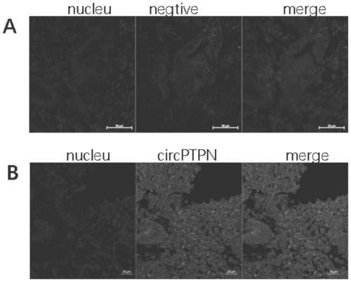 Application of hsa_circ_0003764 as marker to preparation of diagnosis preparation for intrauterine adhesion