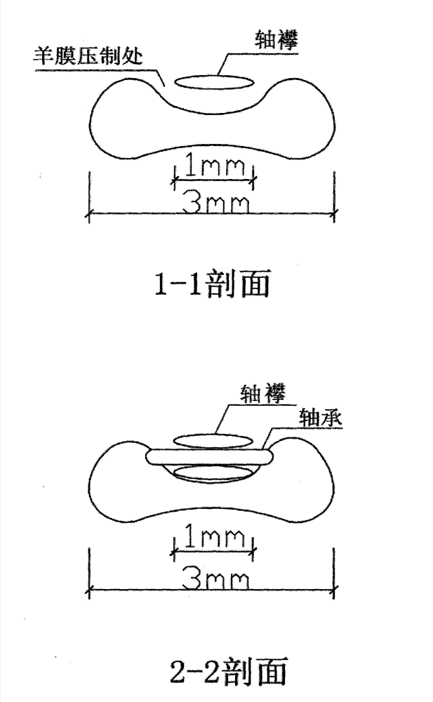 Ocular surface amniotic membrane coverer