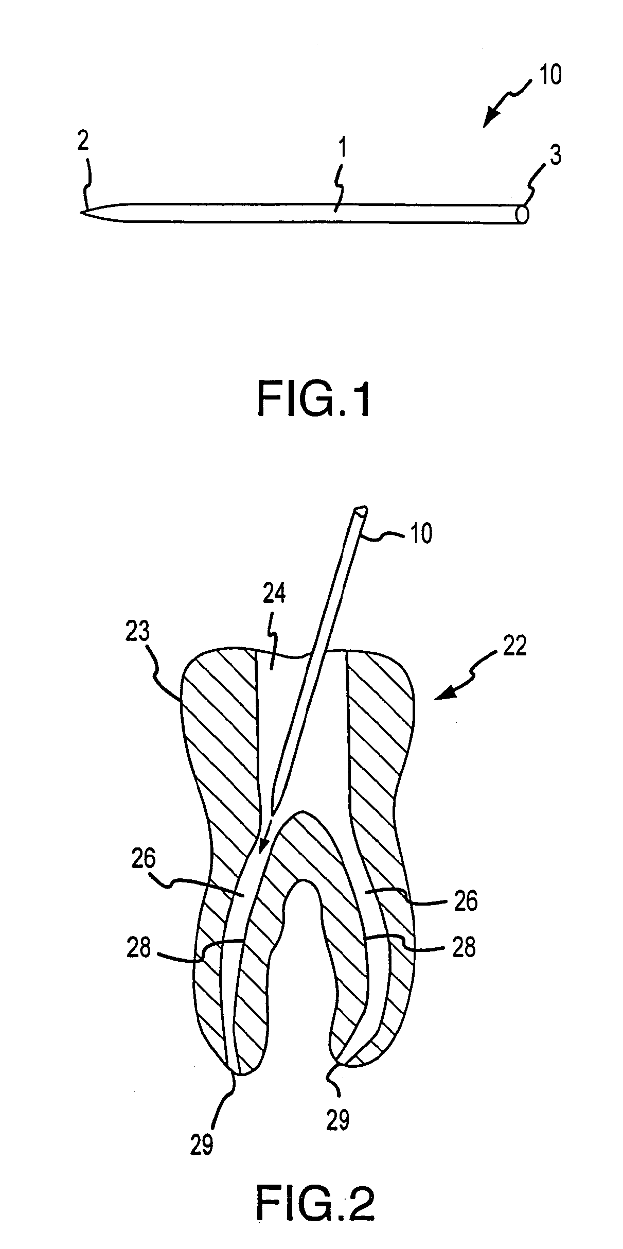 Apparatus and method for root canal obturation