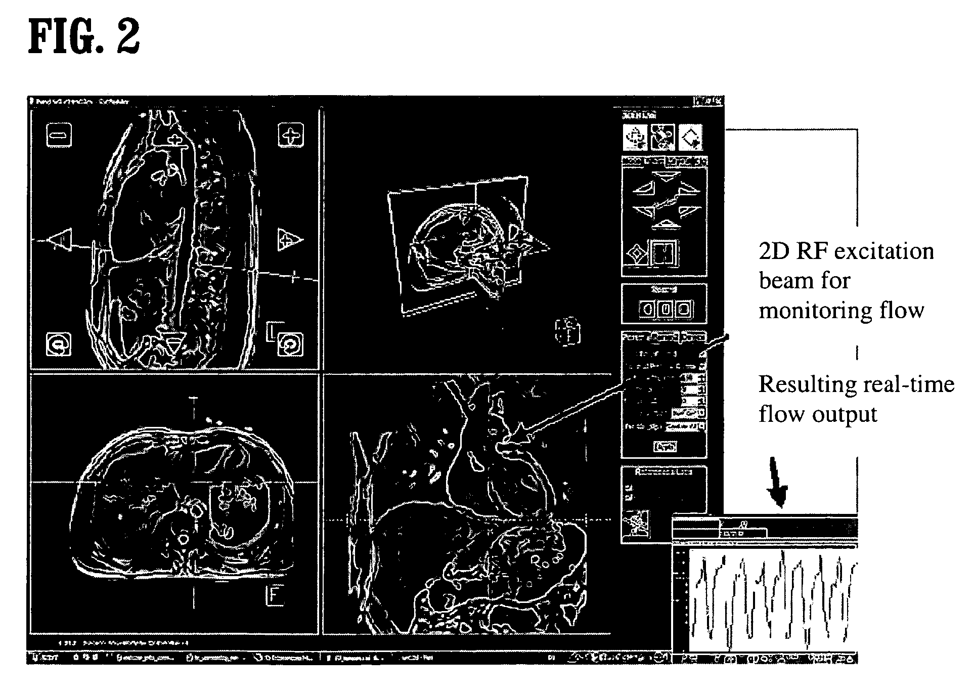 System and method for image based physiological monitoring of cardiovascular function