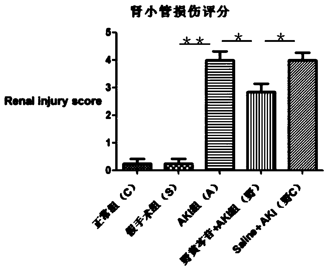 Application of scutellarin to preparing kidney ischemic reperfusion injury preventing/protecting drugs/drug combinations