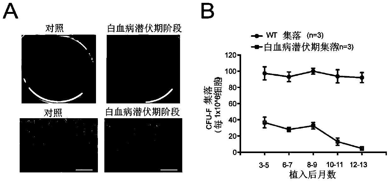 A way to remodel the bone marrow microenvironment