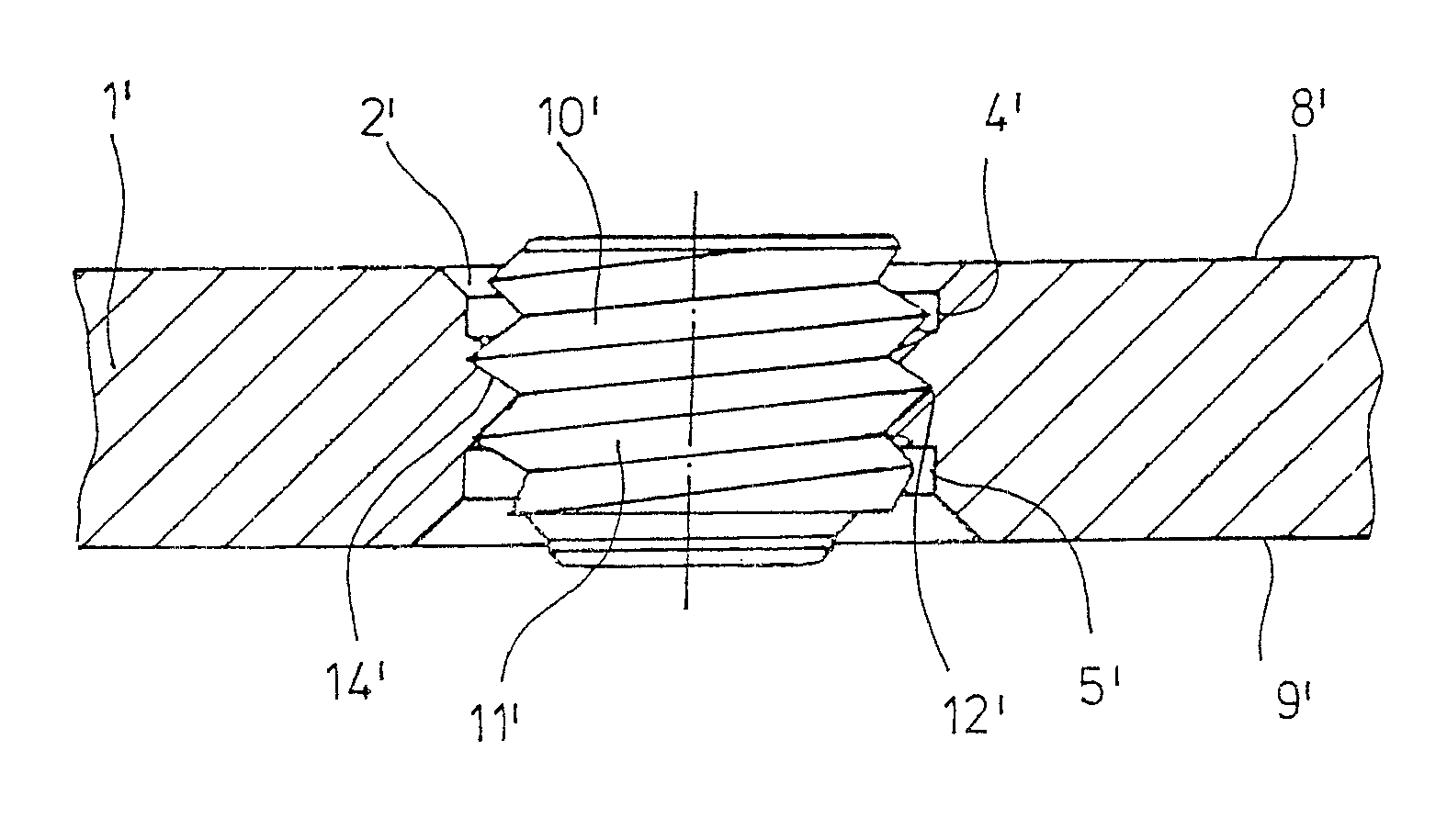 Bone-fixation system and filler element for bone-fixation