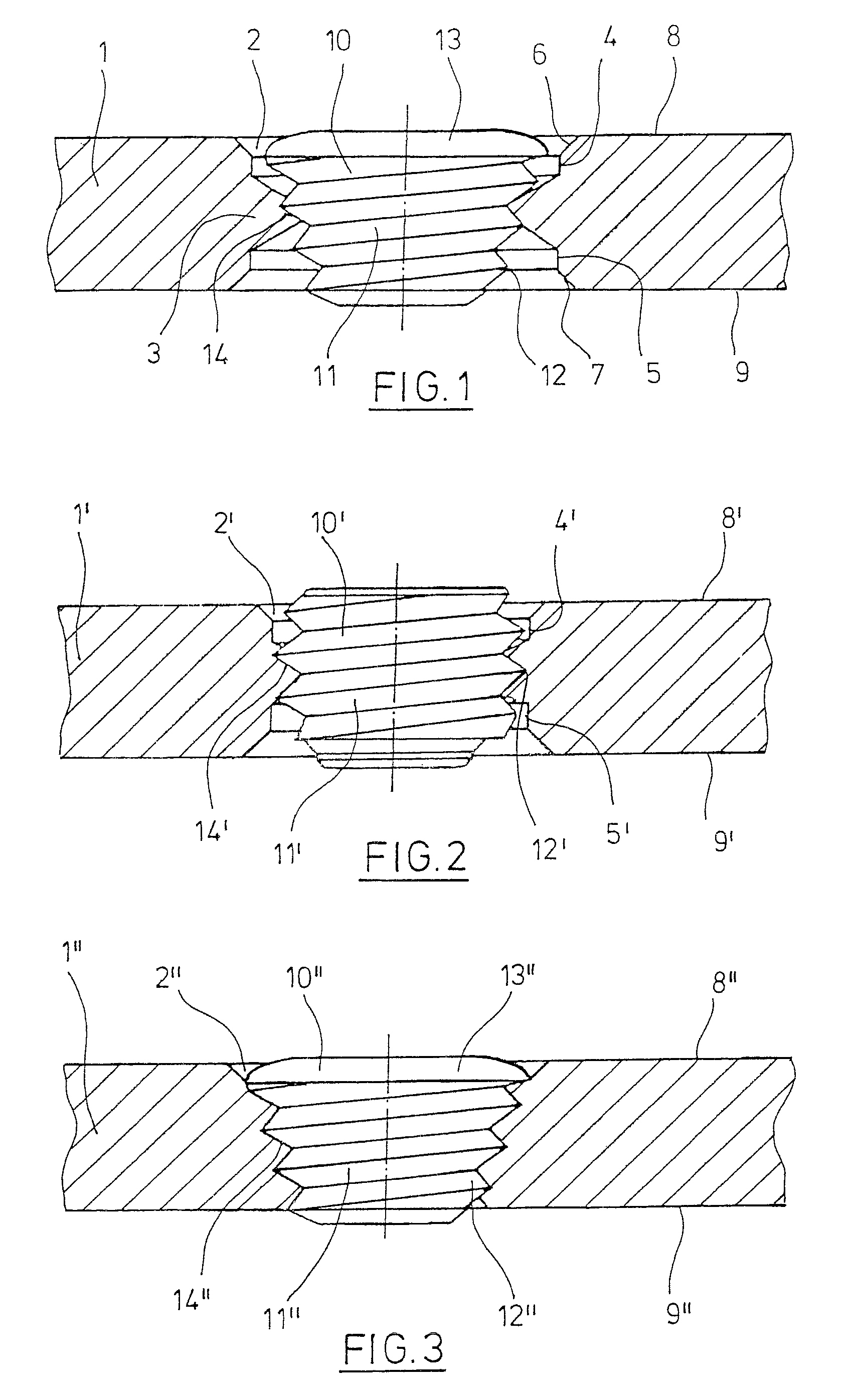 Bone-fixation system and filler element for bone-fixation