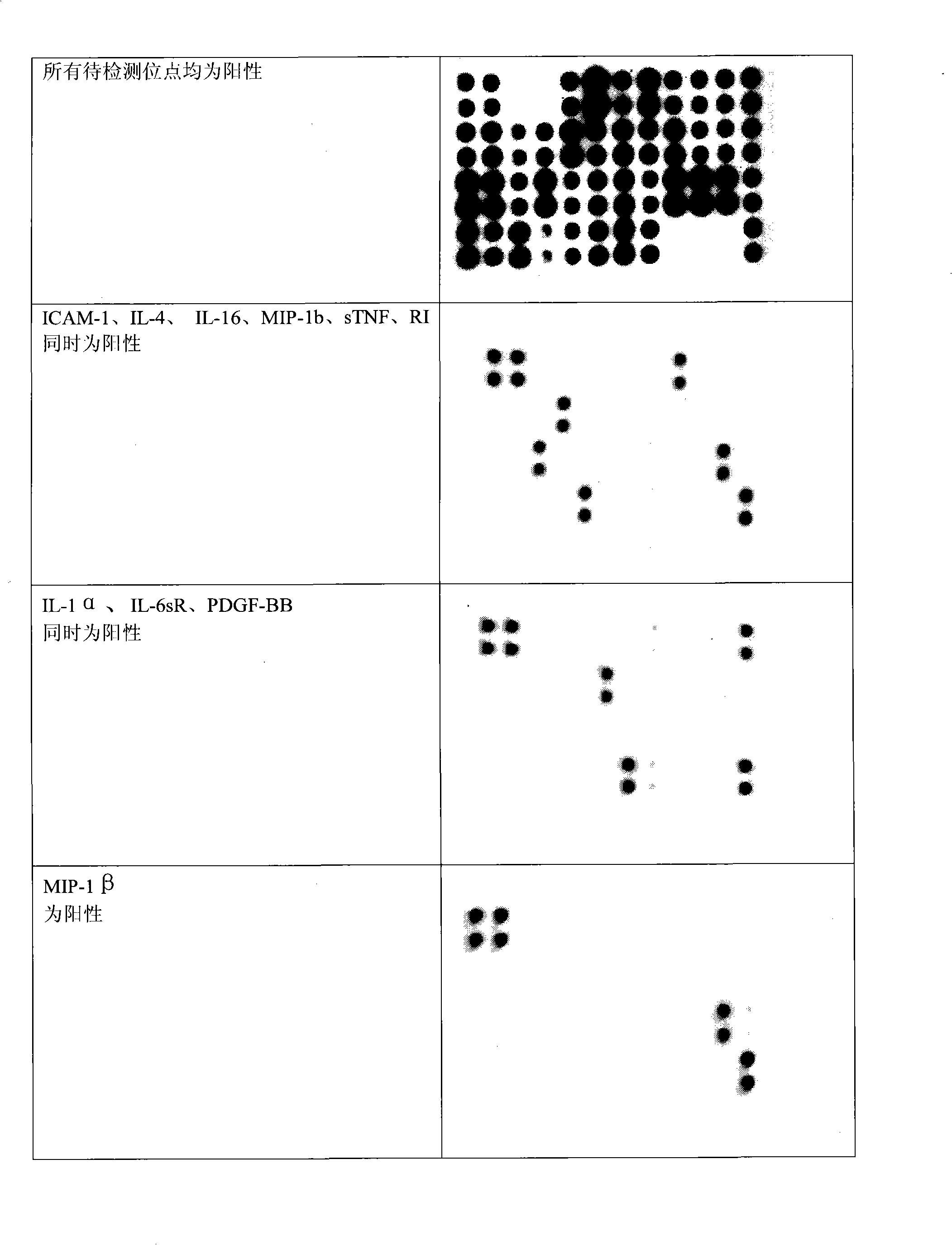 Protein chip kit for detecting inflammatory factors and preparation method thereof