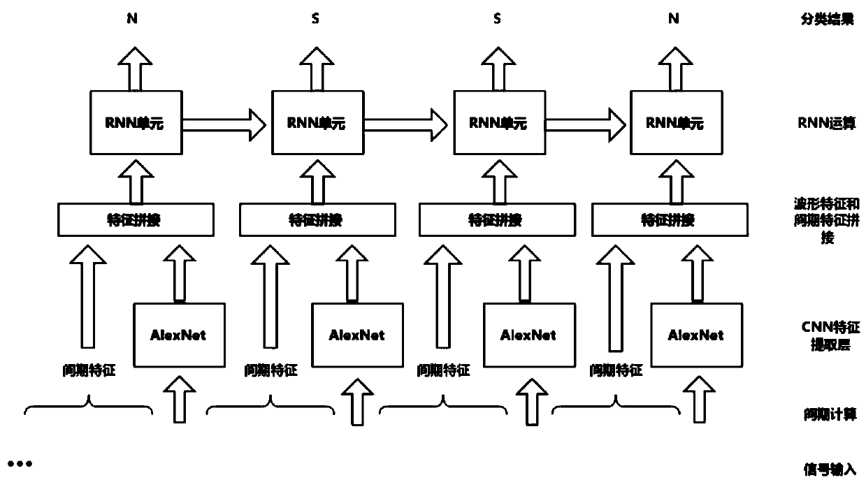 Heartbeat anomaly recognition algorithm based on deep learning technology