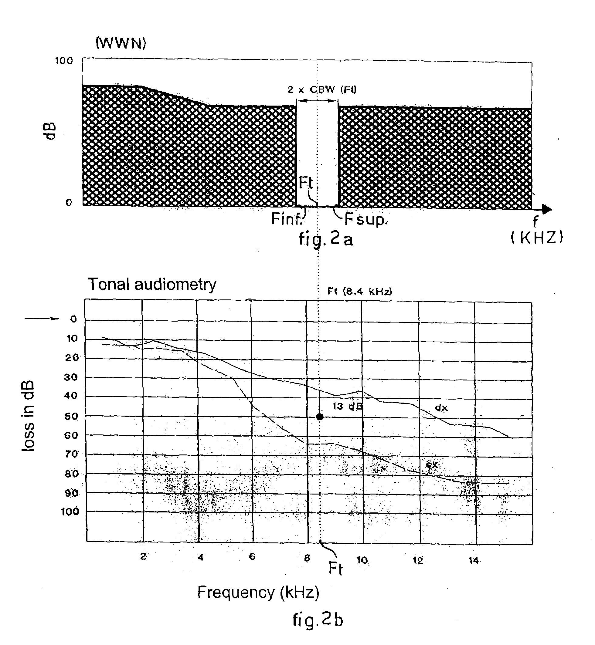 Device for the treatment of tinnitus