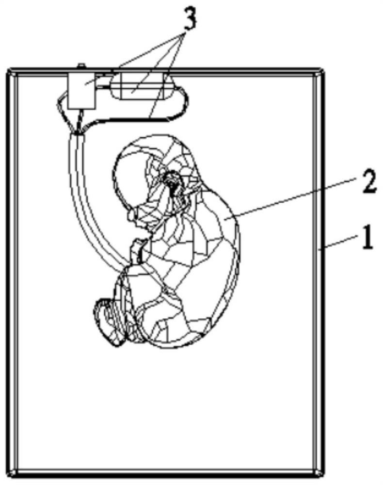 Fetus simulation ultrasonic diagnosis puncture model