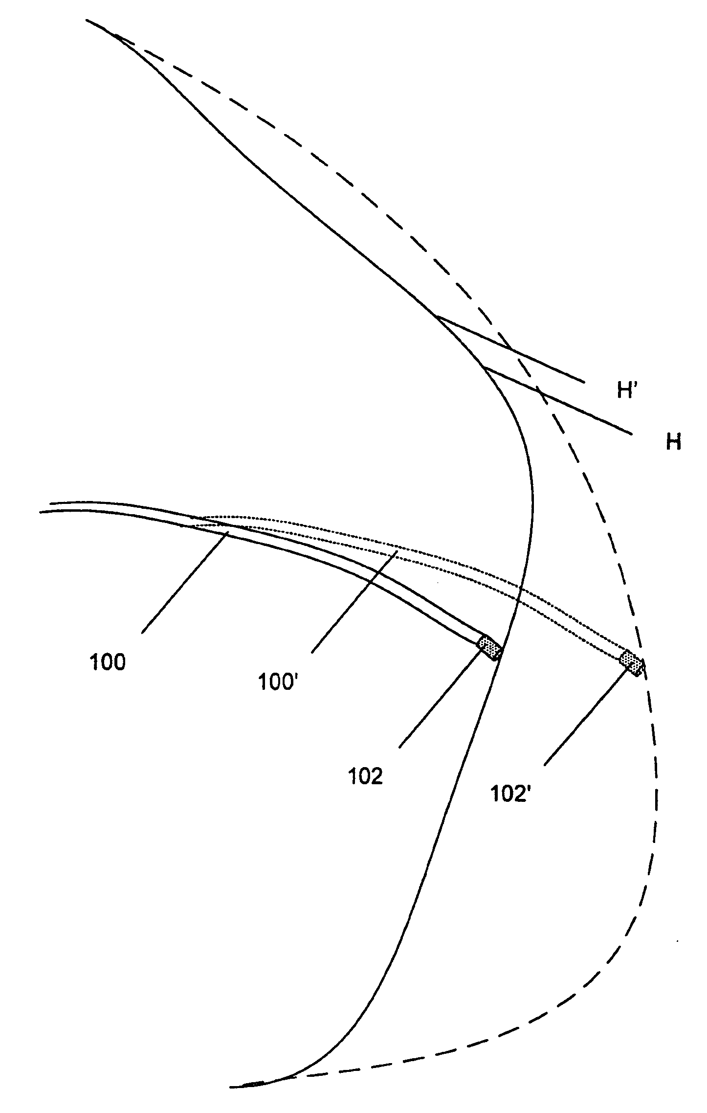 Electrophysiology catheter and system for gentle and firm wall contact