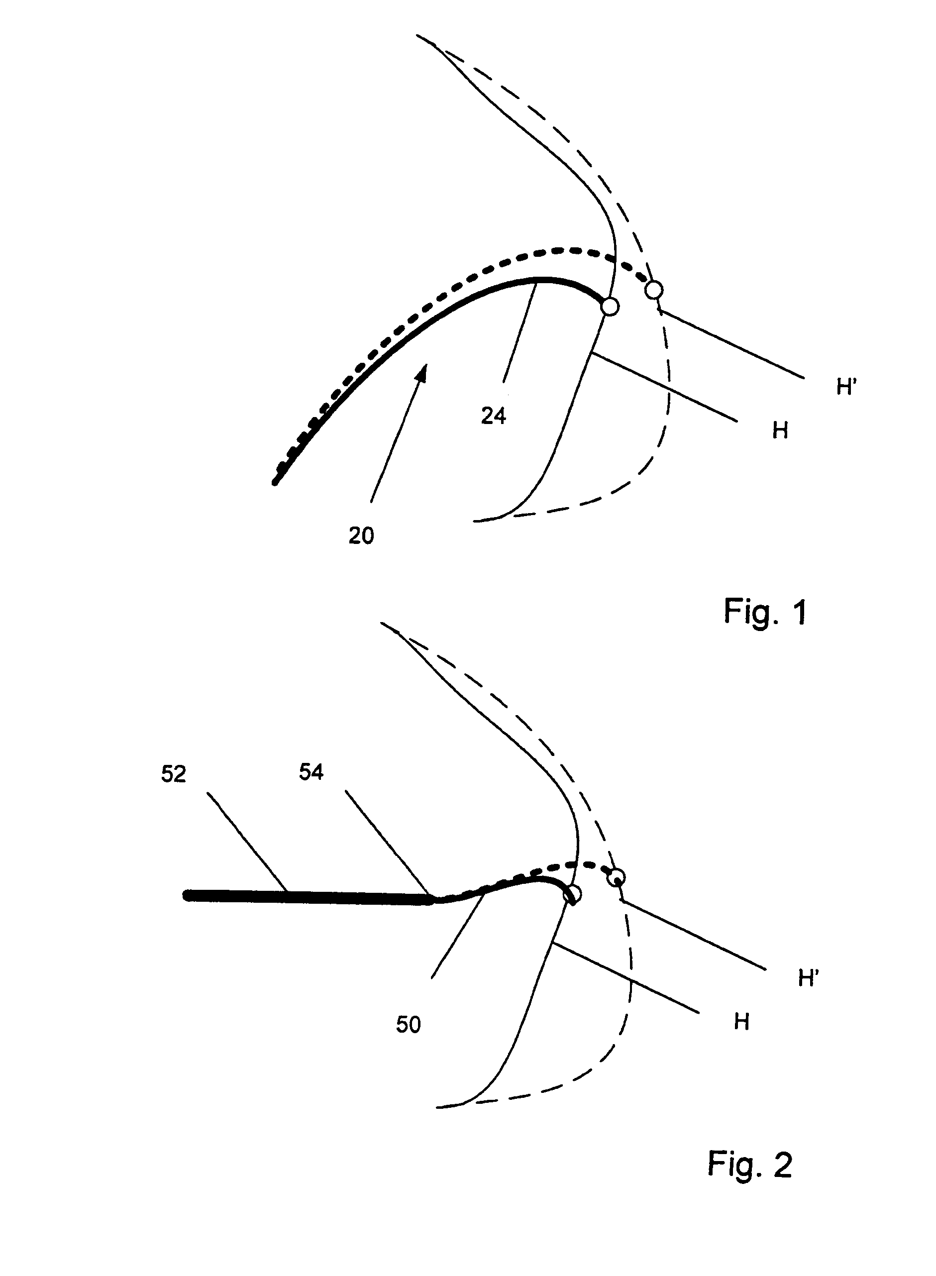 Electrophysiology catheter and system for gentle and firm wall contact