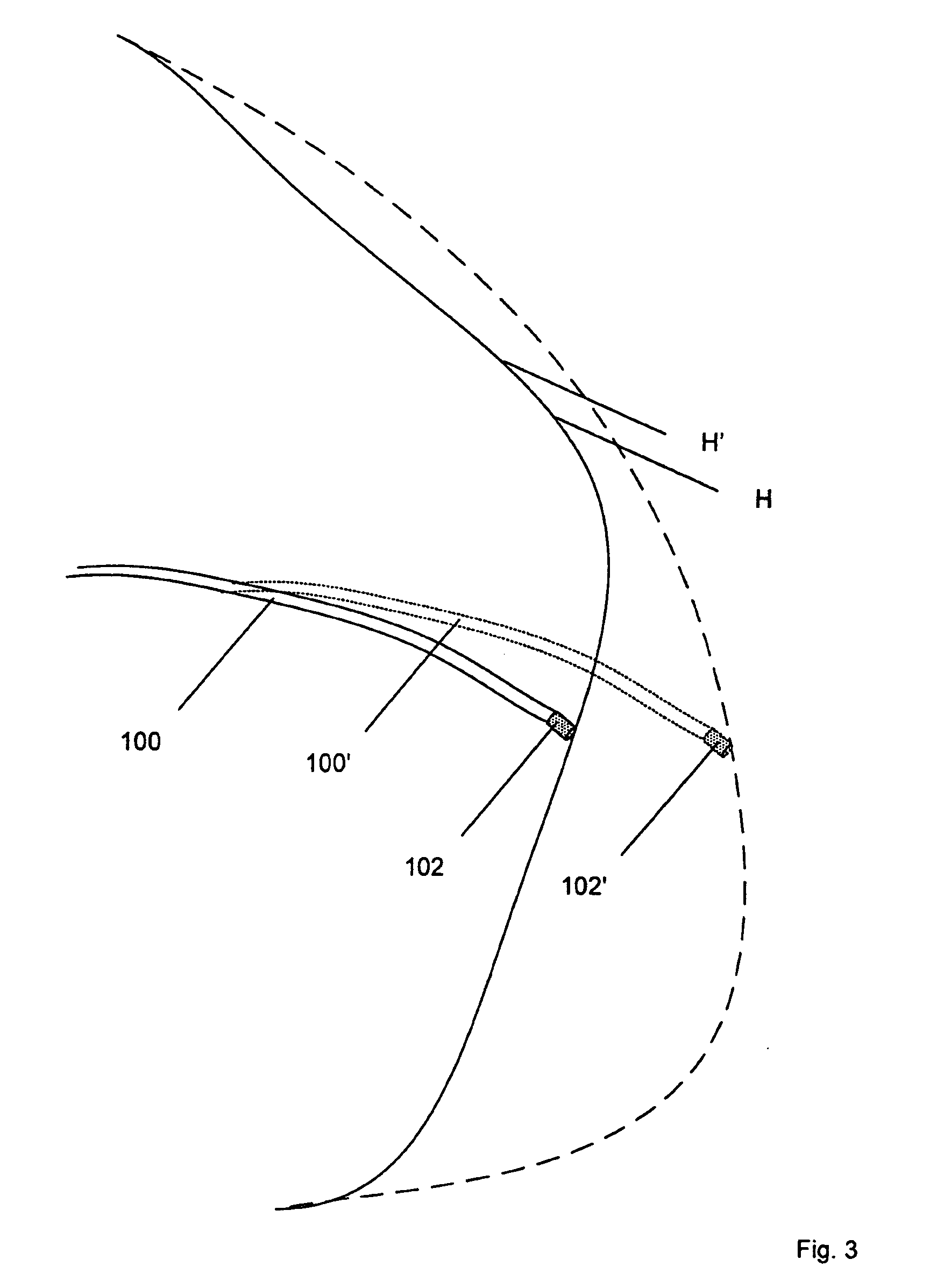 Electrophysiology catheter and system for gentle and firm wall contact