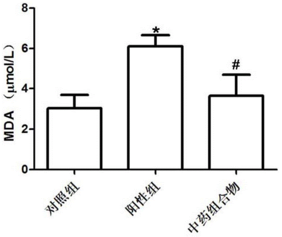 A traditional Chinese medicine composition for improving oxidative stress and treating diabetes and its application