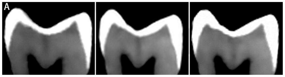 Composite cone beam CT enhanced contrast agent and preparation method thereof