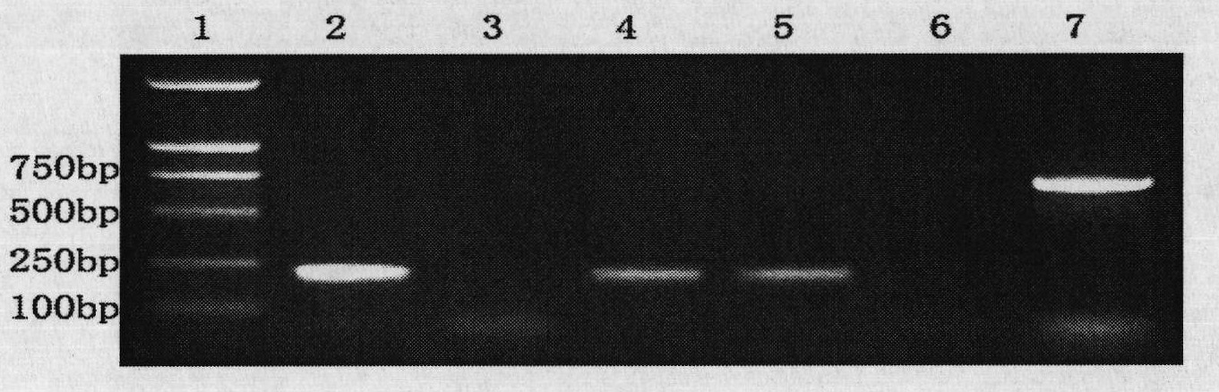 Detection reagent kit and detection method of soybean phytophthora