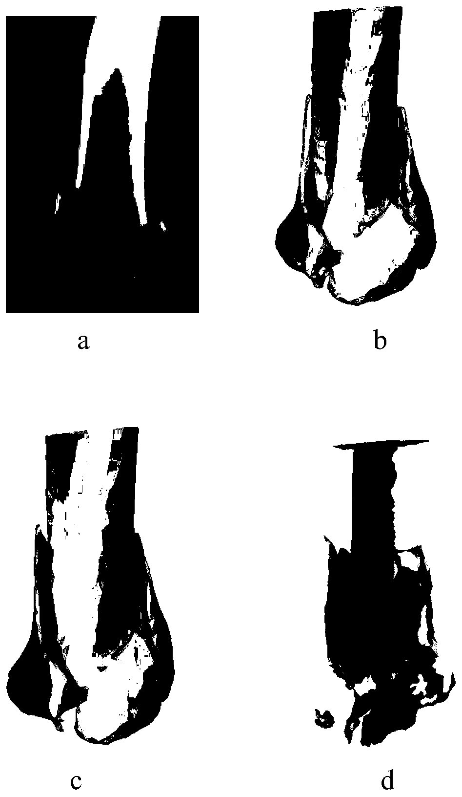 Three-dimensional broken bone segmentation method and device based on deep learning