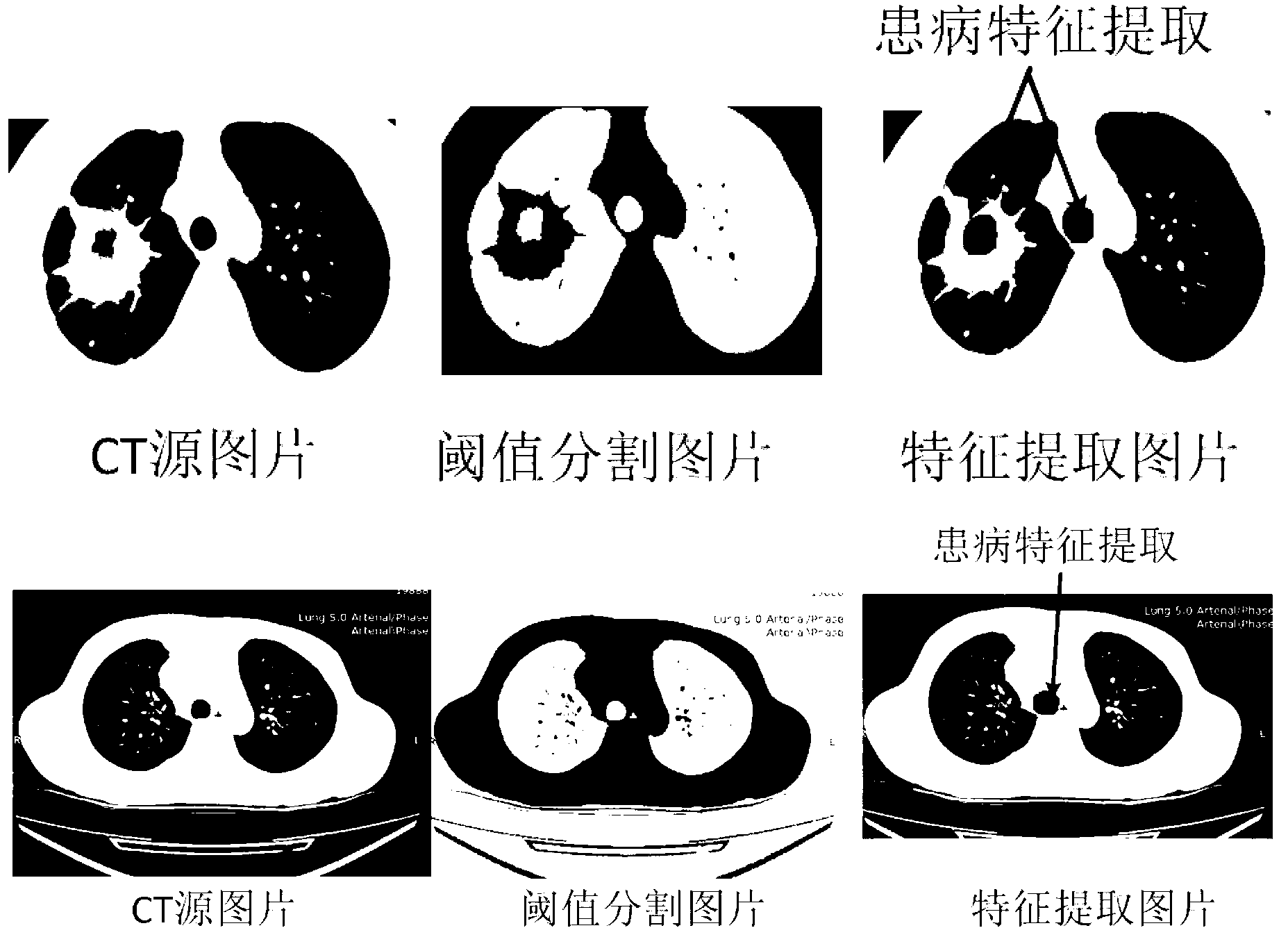 Similarity calculation system and method based on medical image features