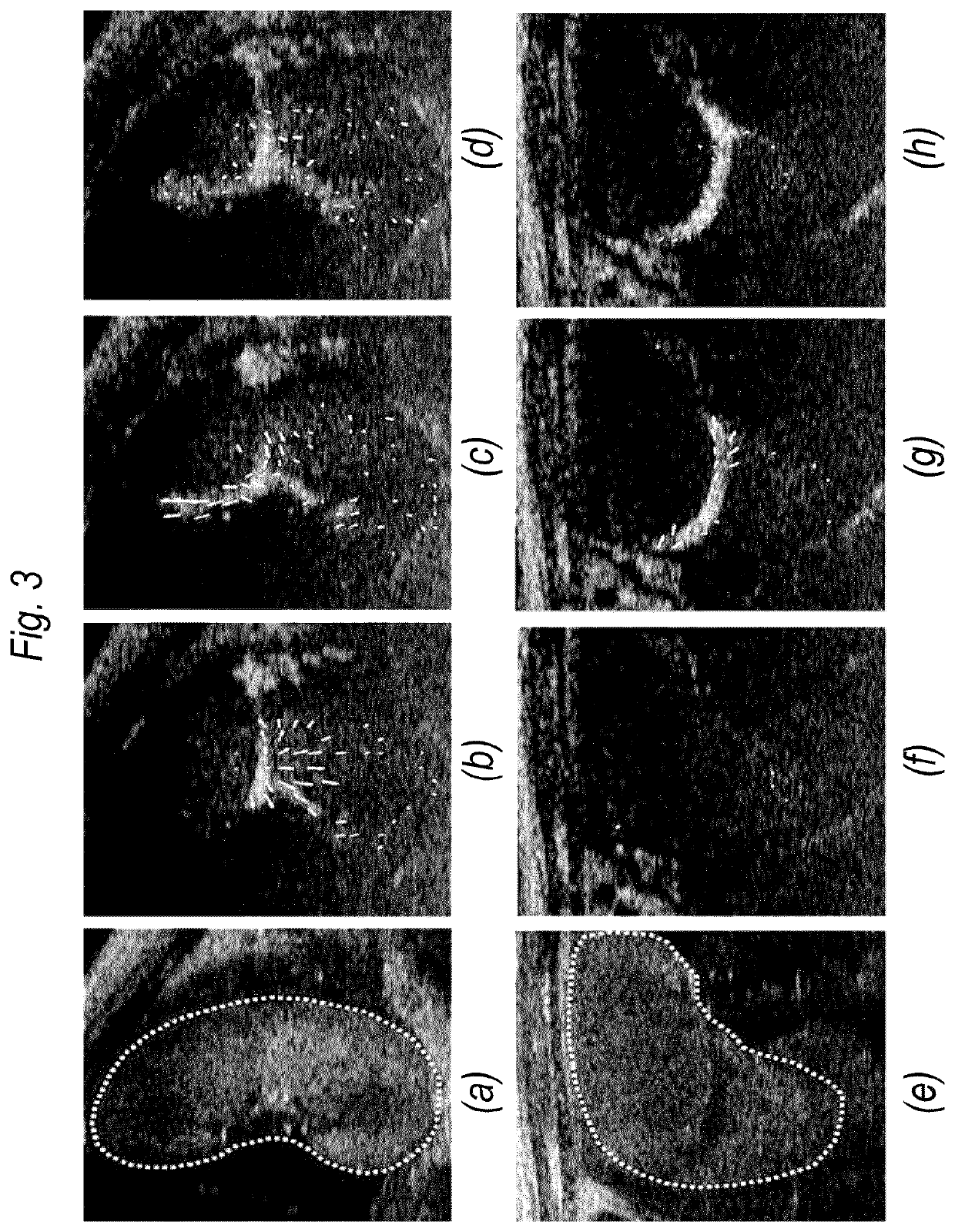 Apparatus and method for contrast-enhanced ultrasound imaging