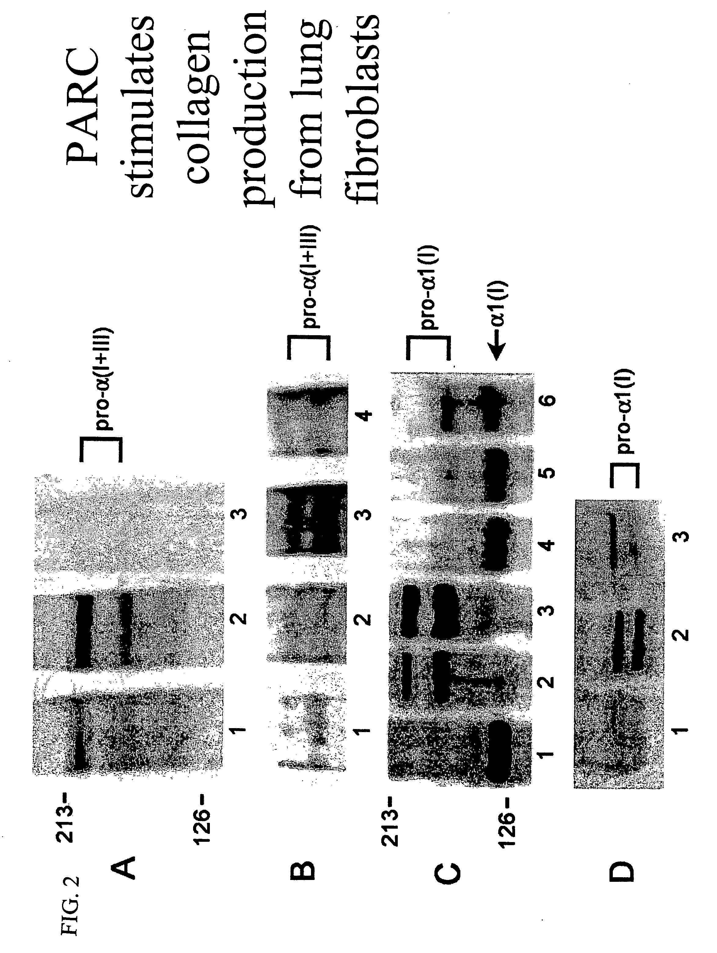 Therapeutic targeting of PARC/CCL18 and its signaling in pulmonary fibrosis