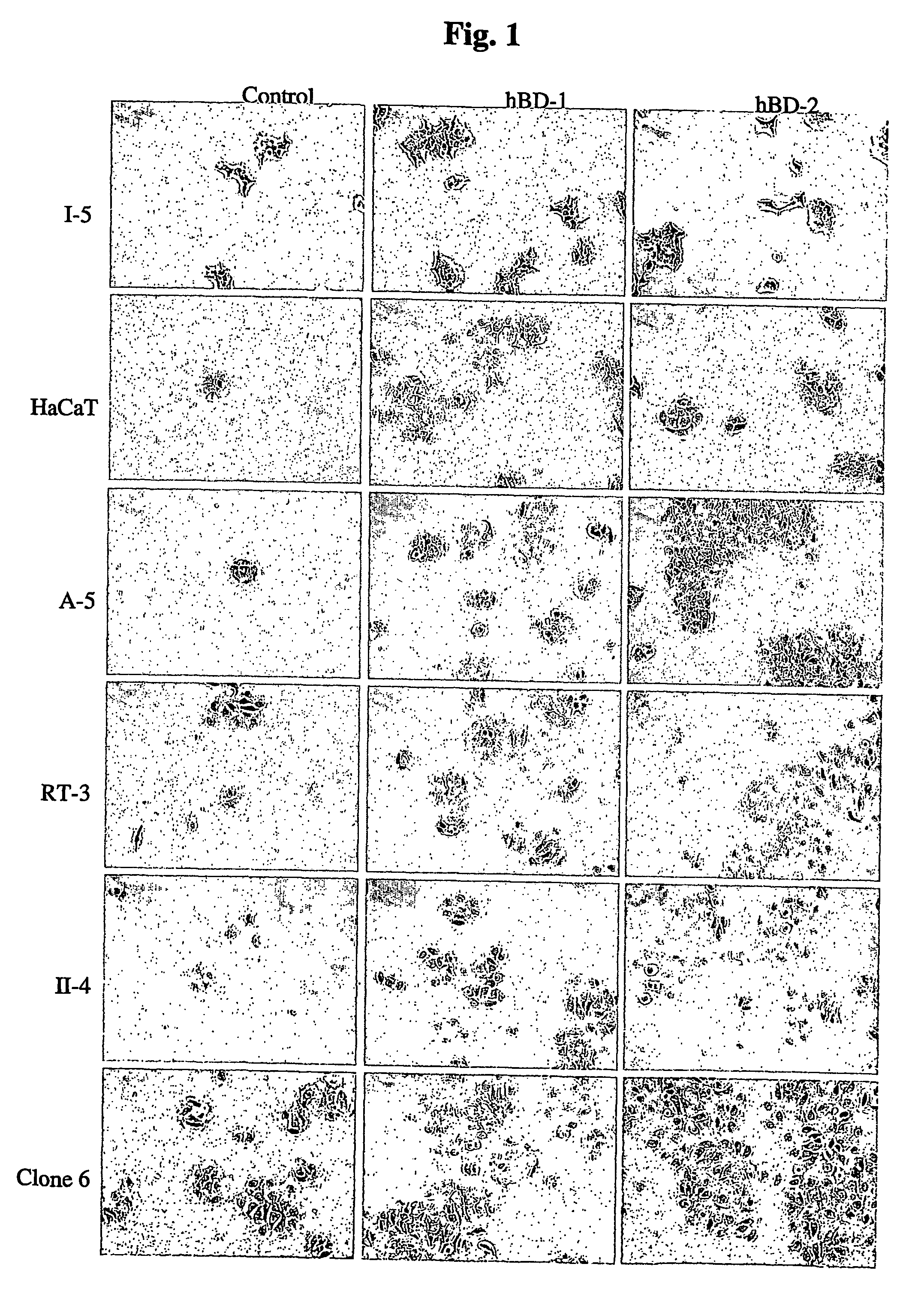 Disease treatment via antimicrobial peptide inhibitors