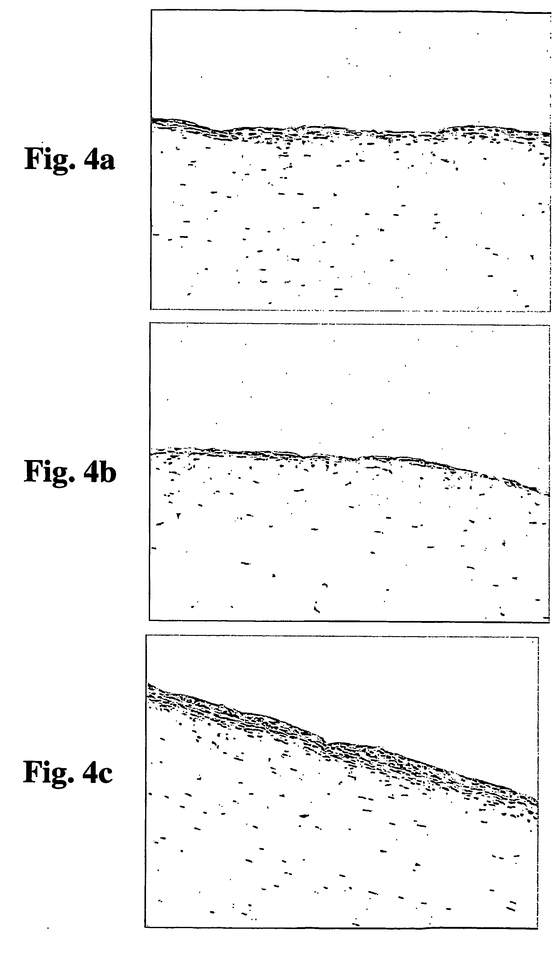 Disease treatment via antimicrobial peptide inhibitors