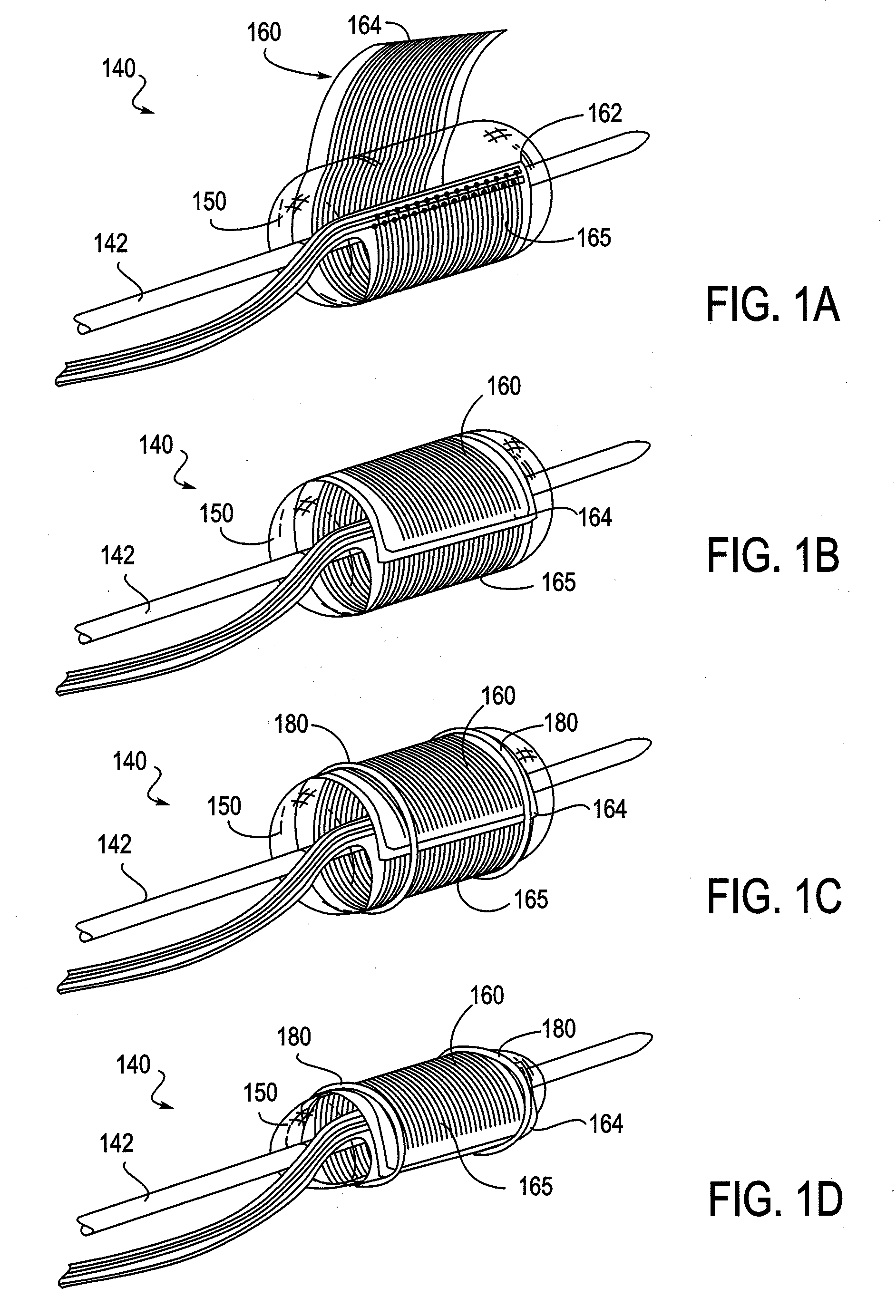 Electrical means to normalize ablational energy transmission to a luminal tissue surface of varying size