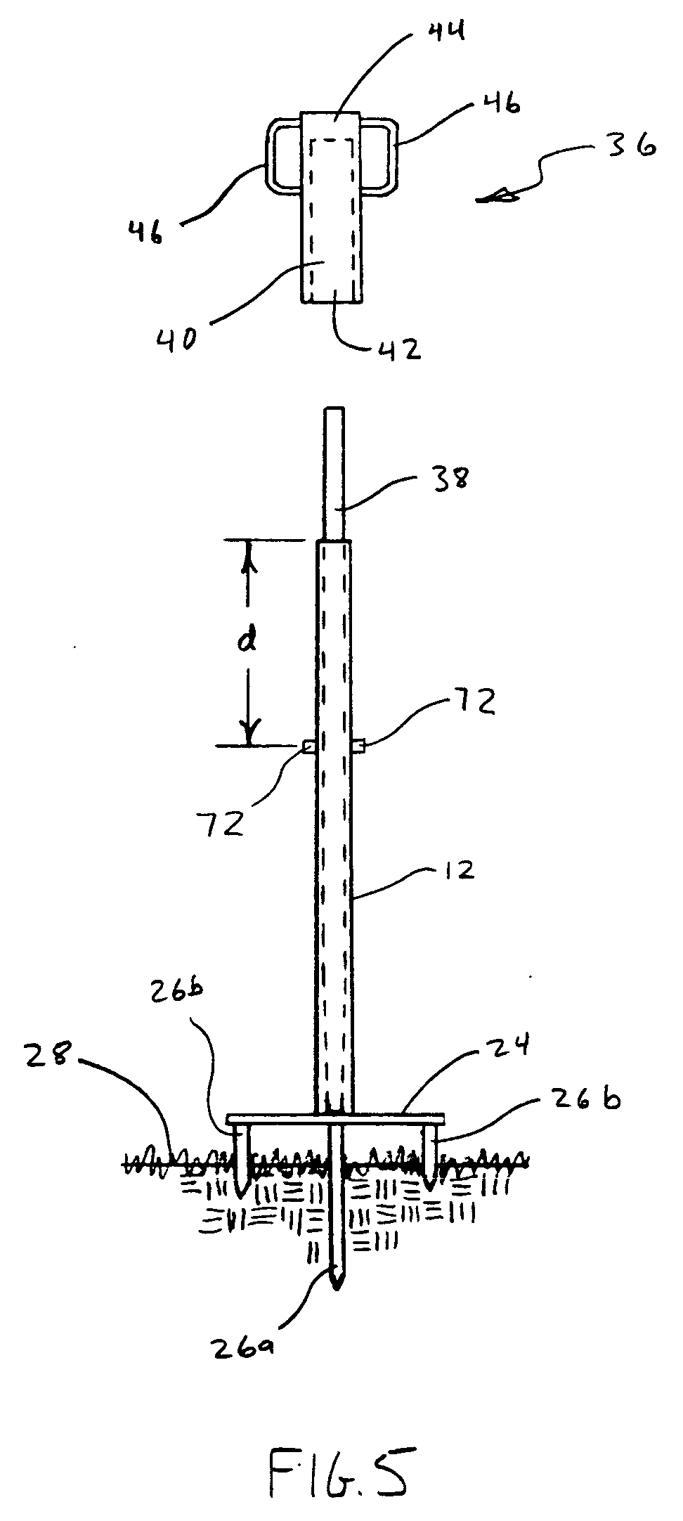 Removable sign support system