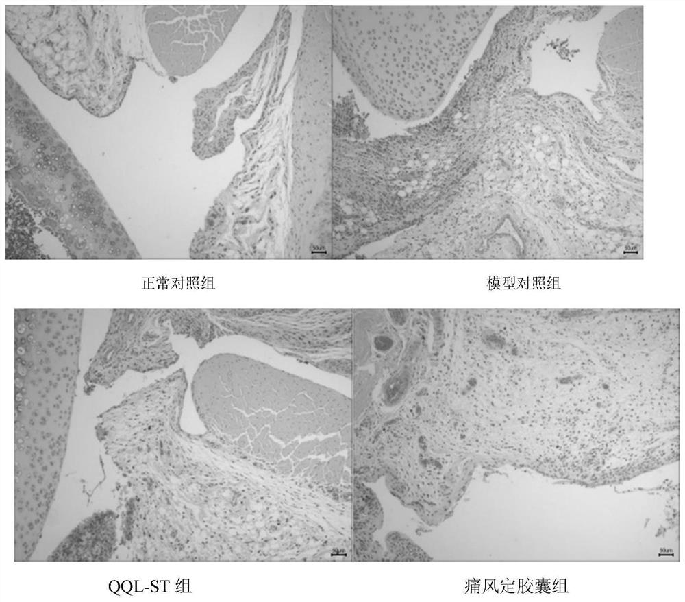 Dammarane tetracyclic triterpene compound and anti-gout application thereof