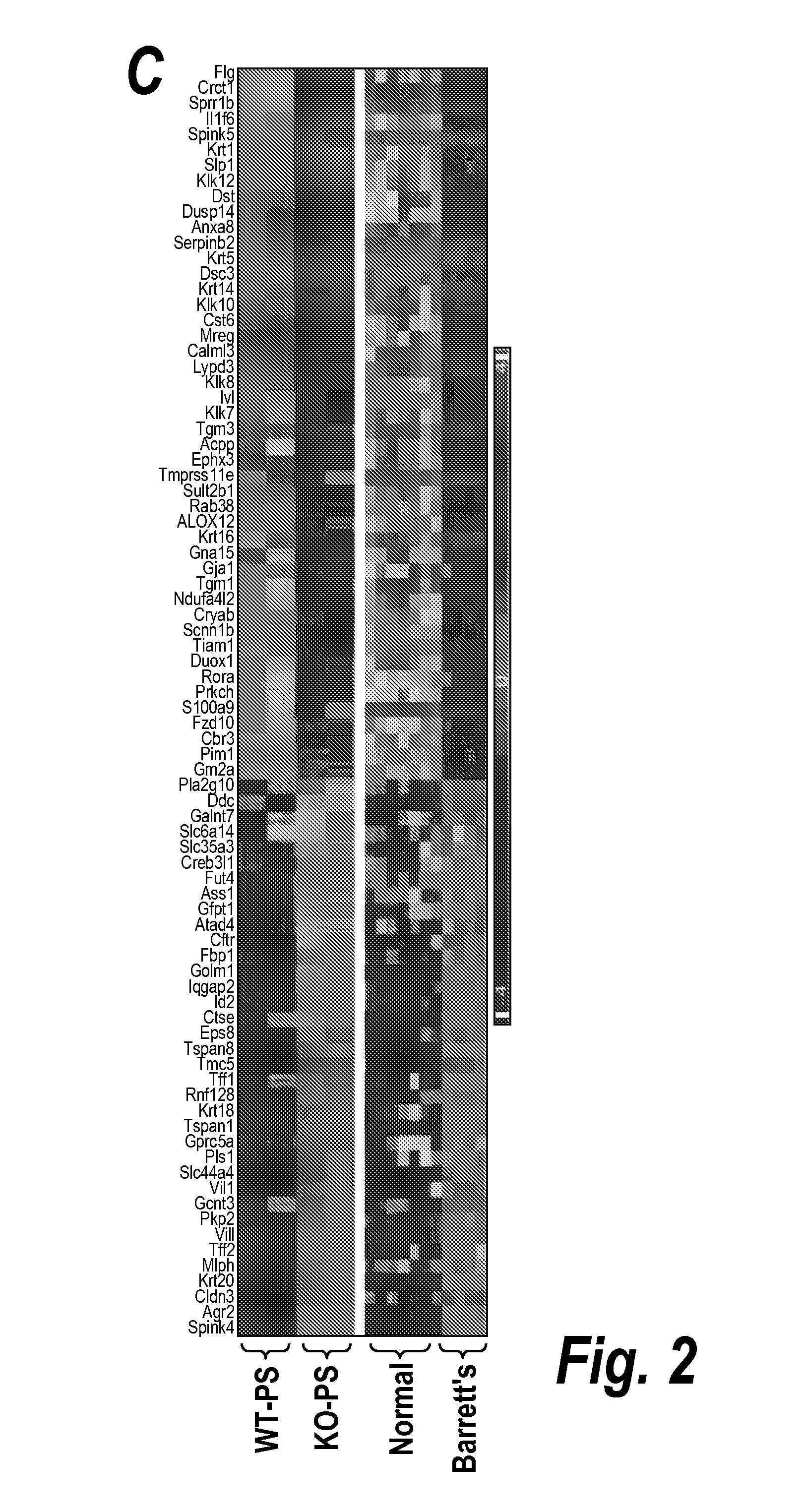 Methods and reagents for detection and treatment of esophageal metaplasia