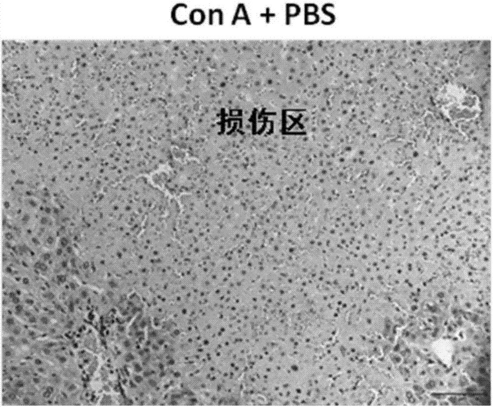 Novel death receptor 5 antibody fusion protein and application thereof