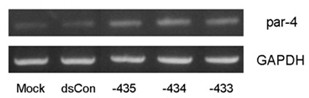 Application of target up-regulation PAR-4 gene small ribonucleic acid (RNA) in preparing bladder cancer resisting drugs