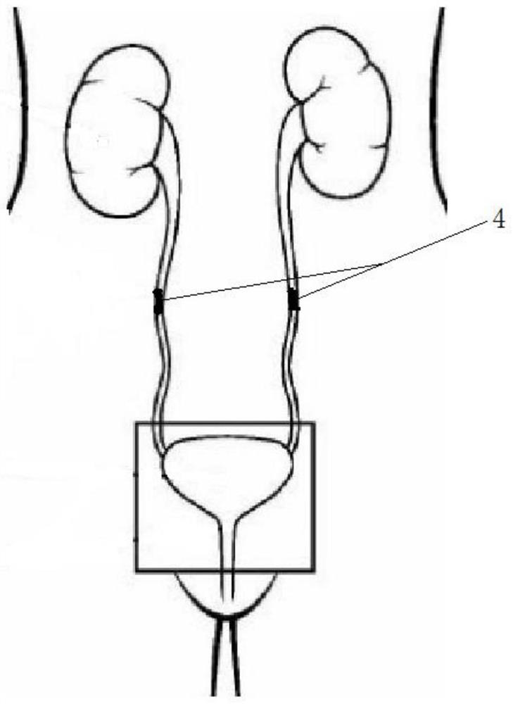 An autonomous urination assist device and method