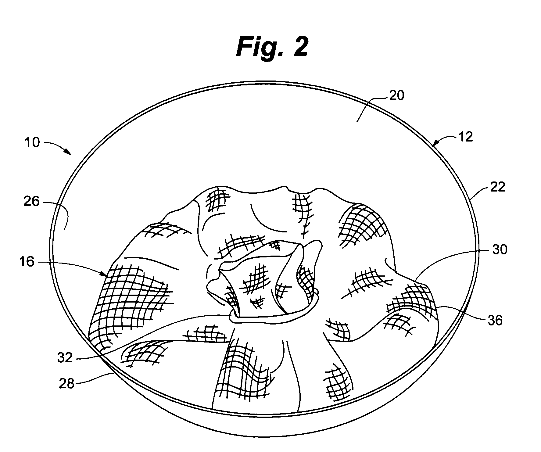 Cartridge assembly having an integrated retention system