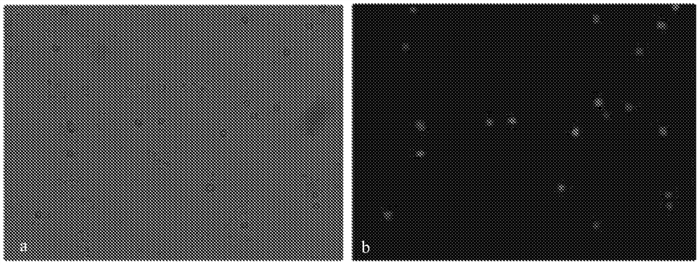 Preservation solution for peripheral blood samples of pregnant women and preservation method for peripheral blood samples of pregnant women