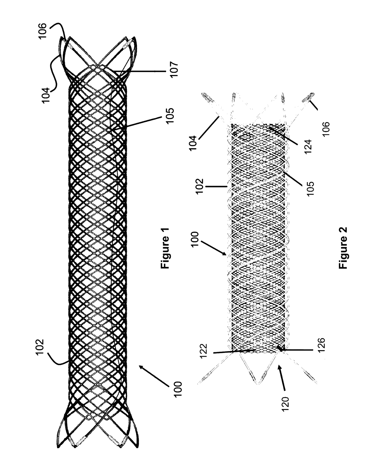 Releasable Delivery System