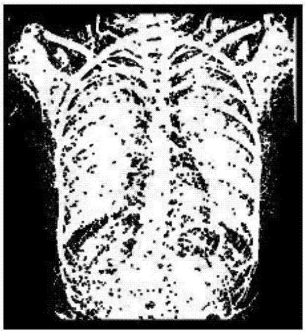 Chest digital image cardiothoracic ratio measuring method