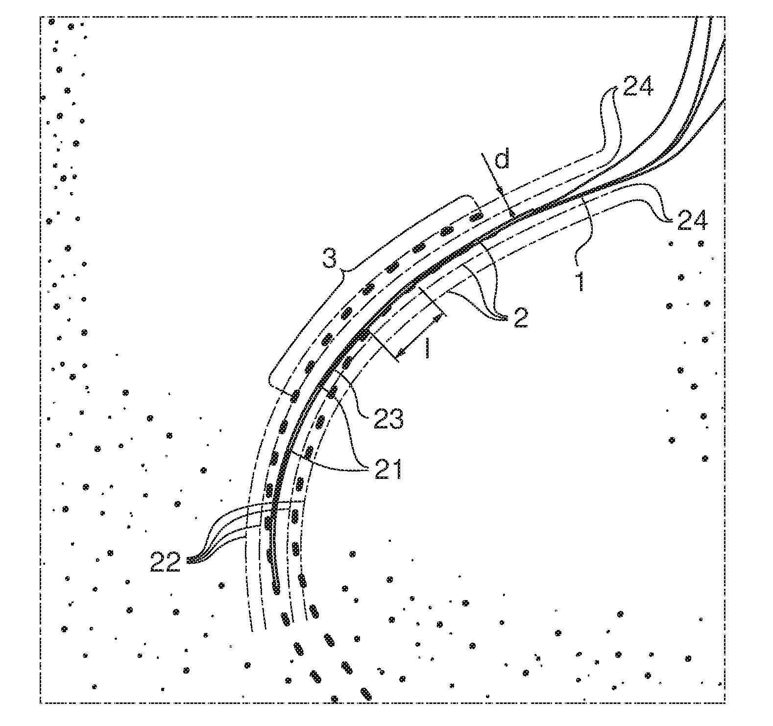 Imaging method of a zone of a patient's body superposing distance marking