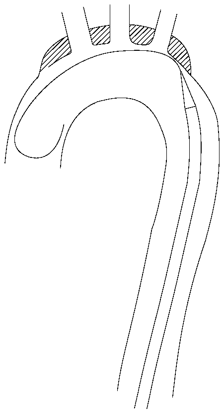 Conveying sheath